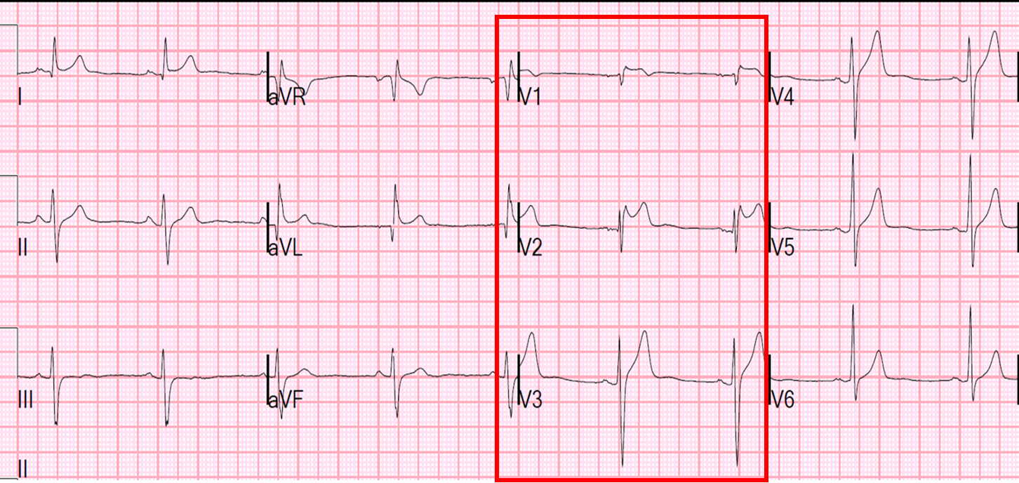 <p>what is this?</p>