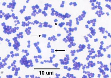 <p>pairs and tetrads and ultimately irregular clusters</p>