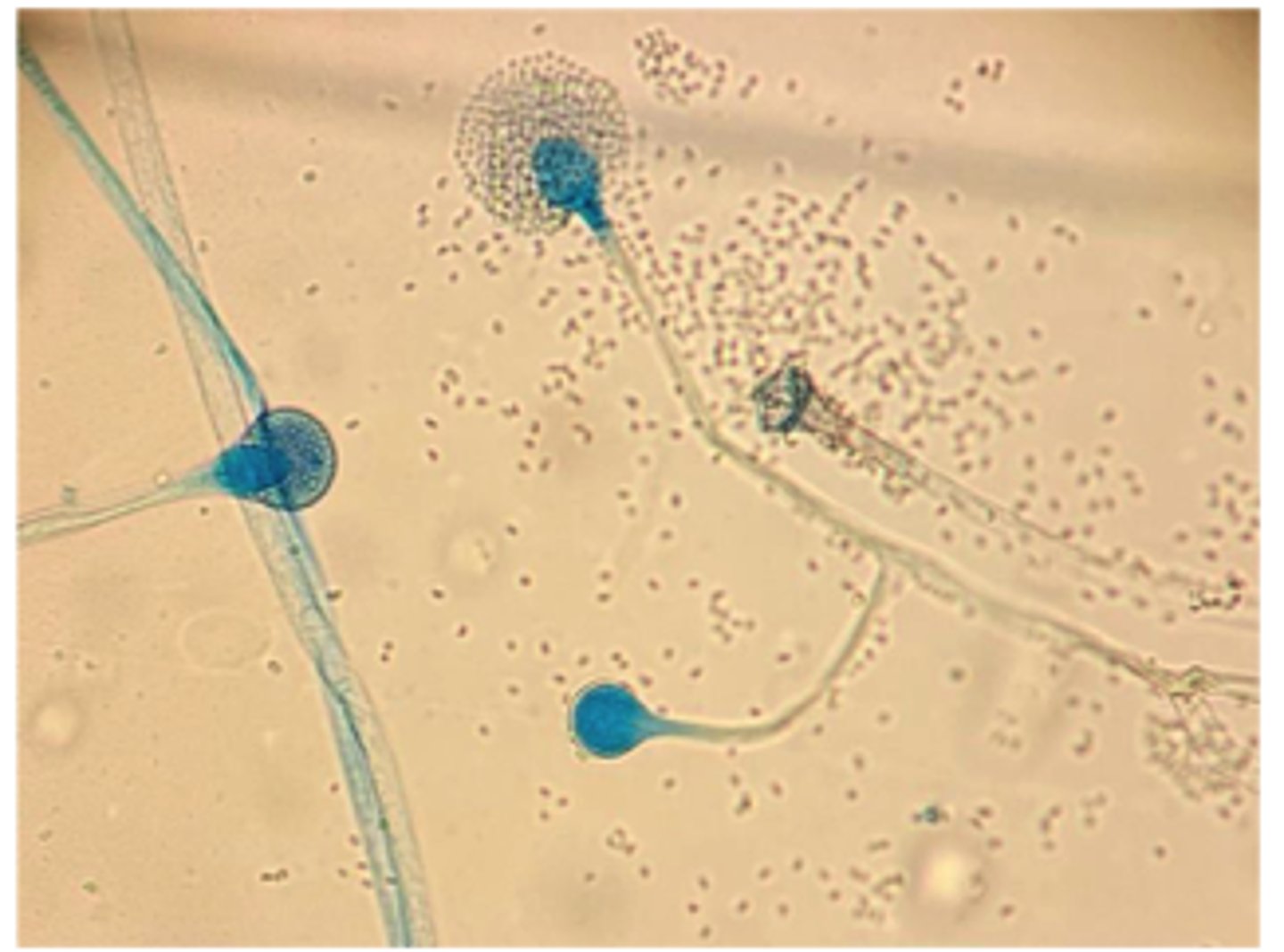 <p>A dairy farmer notices one of his cows aborts in late gestation during a period of poor-quality, moist feed storage. At necropsy, the placenta appears thickened and necrotic.Histopathology of the placenta reveals broad, aseptate hyphae ------- spp.Cultures from the placenta grow rapidly on Sabouraud agar with fluffy, cotton-like colonies.</p><p>Lactophenol cotton blue (LPCB)-stained scotch tape lift slide mount of culture growth</p><p>DDX?</p>