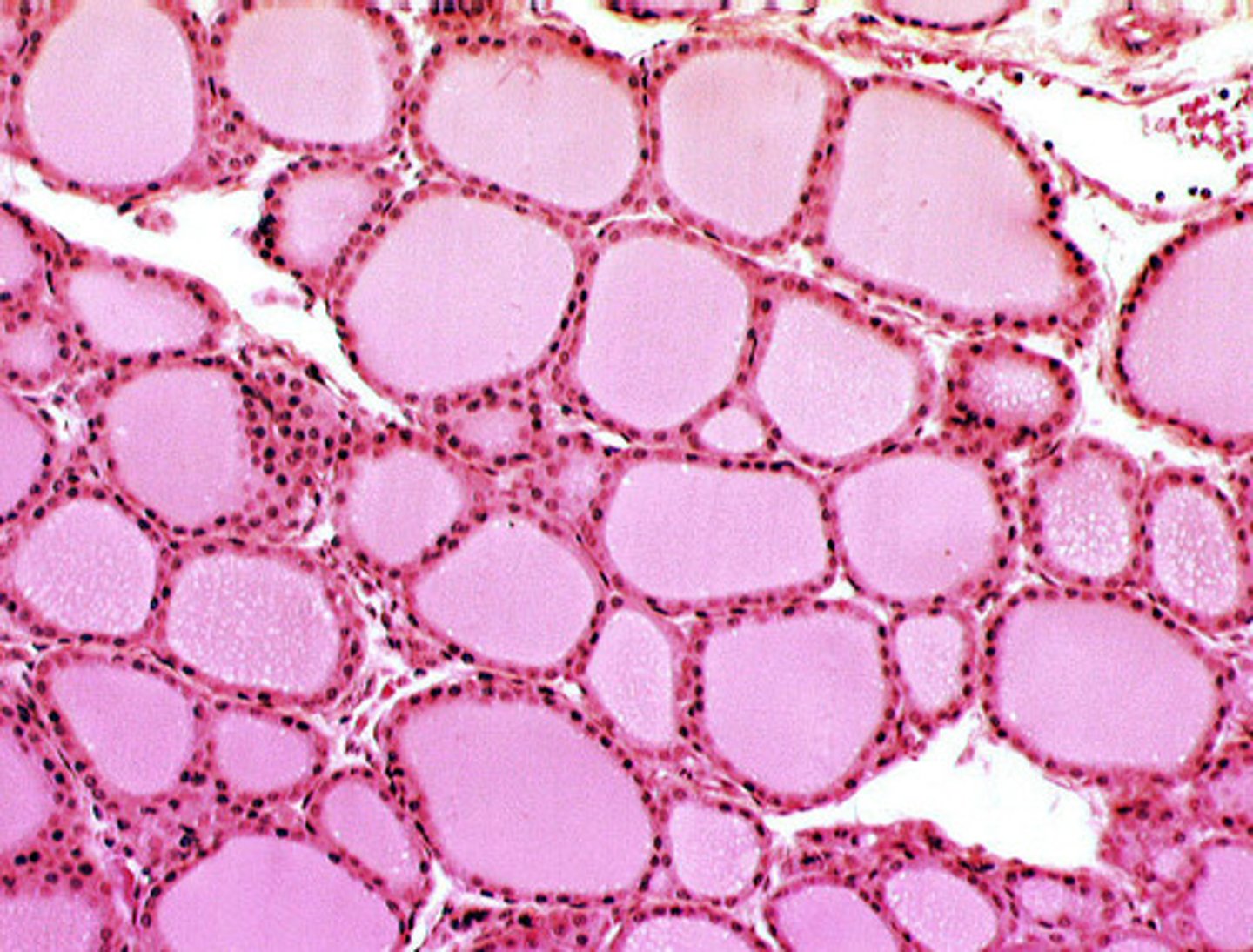 <p>glandular tissue with follicles that secrete T3 and T4</p>