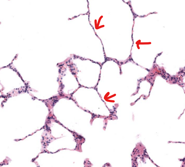 <p>tissue type</p>