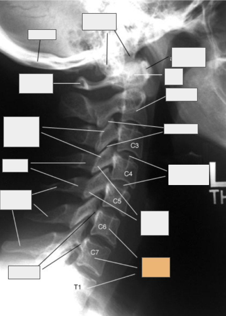 <p>What structure of the spine does the box highlighted in orange reference to?</p>