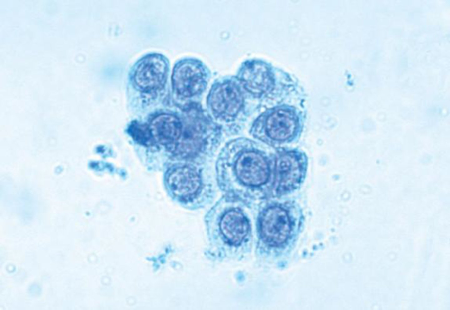 <p>what type of cells are these (urine)</p>