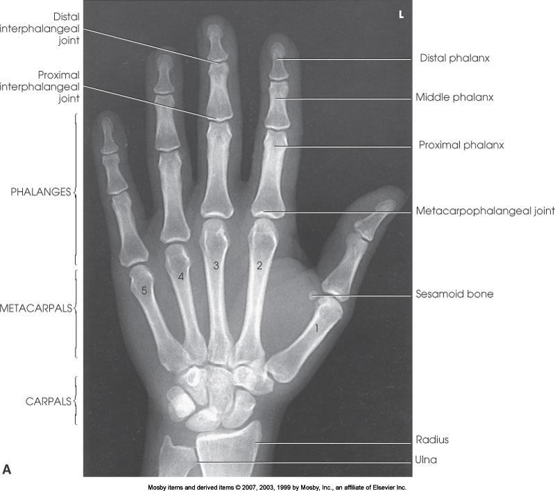 <p>What position is demonstrated?</p>