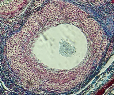 <p>Identify the whole structure presented in the image.</p>