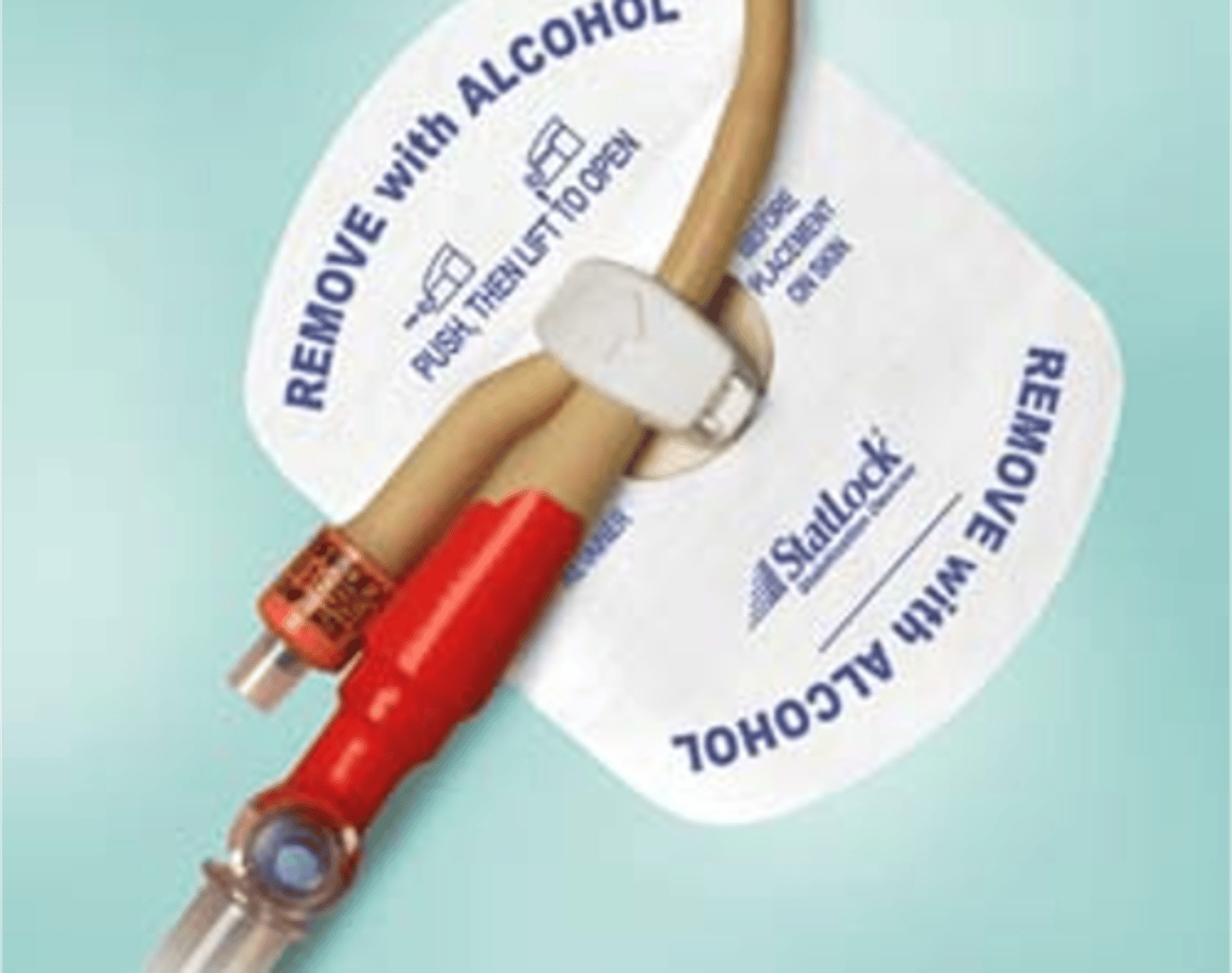 <p>Device to secure catheter after insertion attached to the thigh</p>
