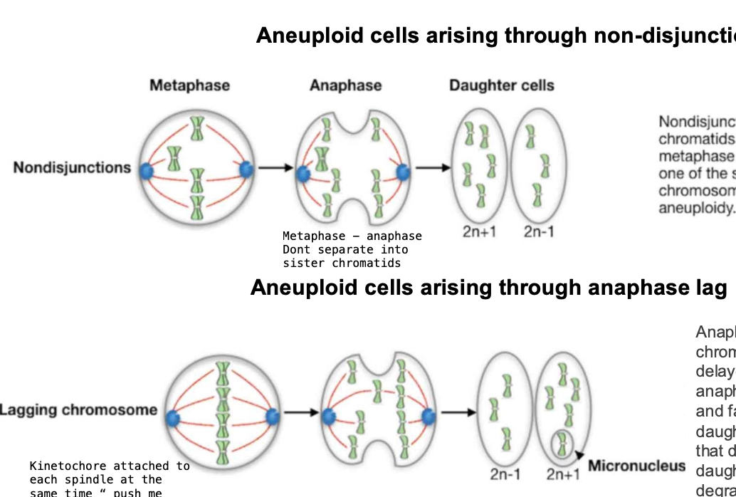 <p>ANEUPLOIDY</p><p>-misalignment / lagging</p><p><u>Misalignment</u></p><p>Sister chromatids <strong>FAIL to align with the metaphase plate</strong></p><p><strong>-Remain at one of the spindle poles</strong> causing aneuploidy</p><p>-BOTH chromatids can enter ONE DAUGHTER CELL</p><p>trisomy / monosomy</p><p></p><p></p><p><u>Anaphase lag</u></p><p>-When a<strong> chromosome</strong> / chromatid is <strong>DELAYED in its movement </strong>during anaphase</p><p>-Lags behind the others + f<strong>ails to be incorporated into the daughter nucleus</strong></p><p>-Chromosomes that do not enter the nucleus of a daughter cell are eventually <strong>DEGRADED</strong></p><p>or SOMETIMES persist in micronuclei as small membrane - bound vesicles</p><p></p><p>ANAPHASE LAG MECHANISM</p><p>-involves <strong>Merotelic attachements</strong></p><p>Instead of the kinetochore being attached to one spindle pole, it is attached to microtubules from both spindle poles</p><p>-PUSH ME PULL ME EFFECT</p><p>-the chromosomes are pushed + pulled but dont move</p><p>lagging - may be excluded from the daughter cell</p><p></p>