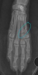 <p><span style="background-color: transparent;"><strong>Carpal, Metacarpal, Digital, Metatarsal Fractures</strong></span></p>