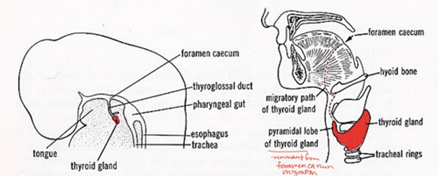 <p>remnant from foramen caecum migration</p>