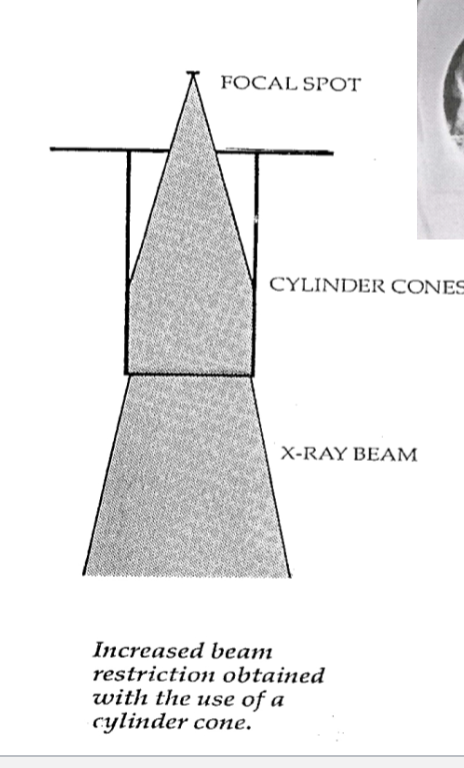 <p><strong>Why does a cylinder cone reduce blur in radiographic imaging?</strong></p>