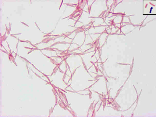 <p>Long thin tapered GNRs</p>