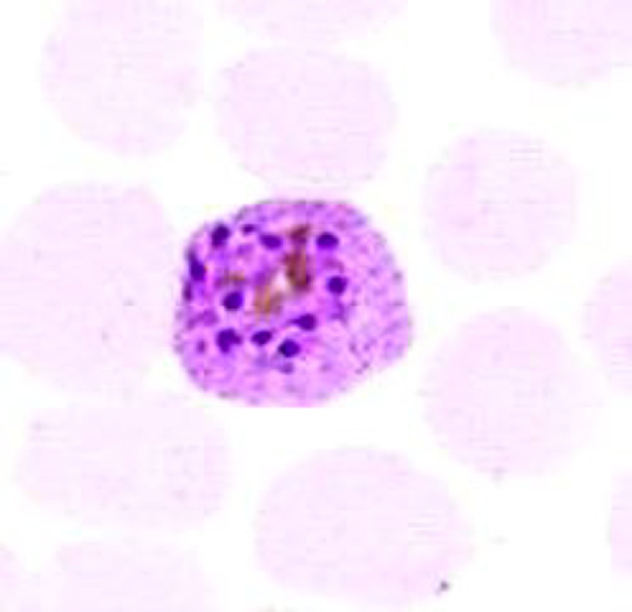 <p>Name the stage and species.</p><p>NOTE: 12-24 merozoites</p>
