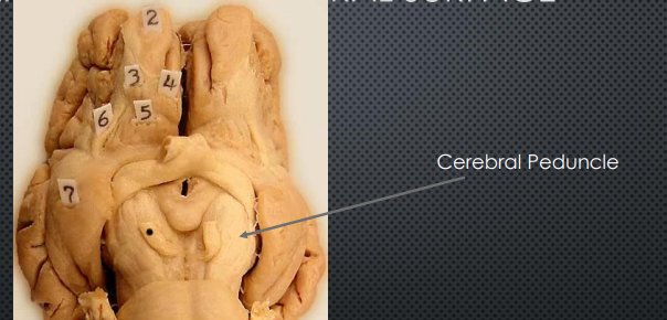 <ul><li><p>Cerebral Peduncle </p><ul><li><p>Large white matter stalks; descending motor fibers from cortex to the brainstem </p></li></ul></li></ul><p></p>