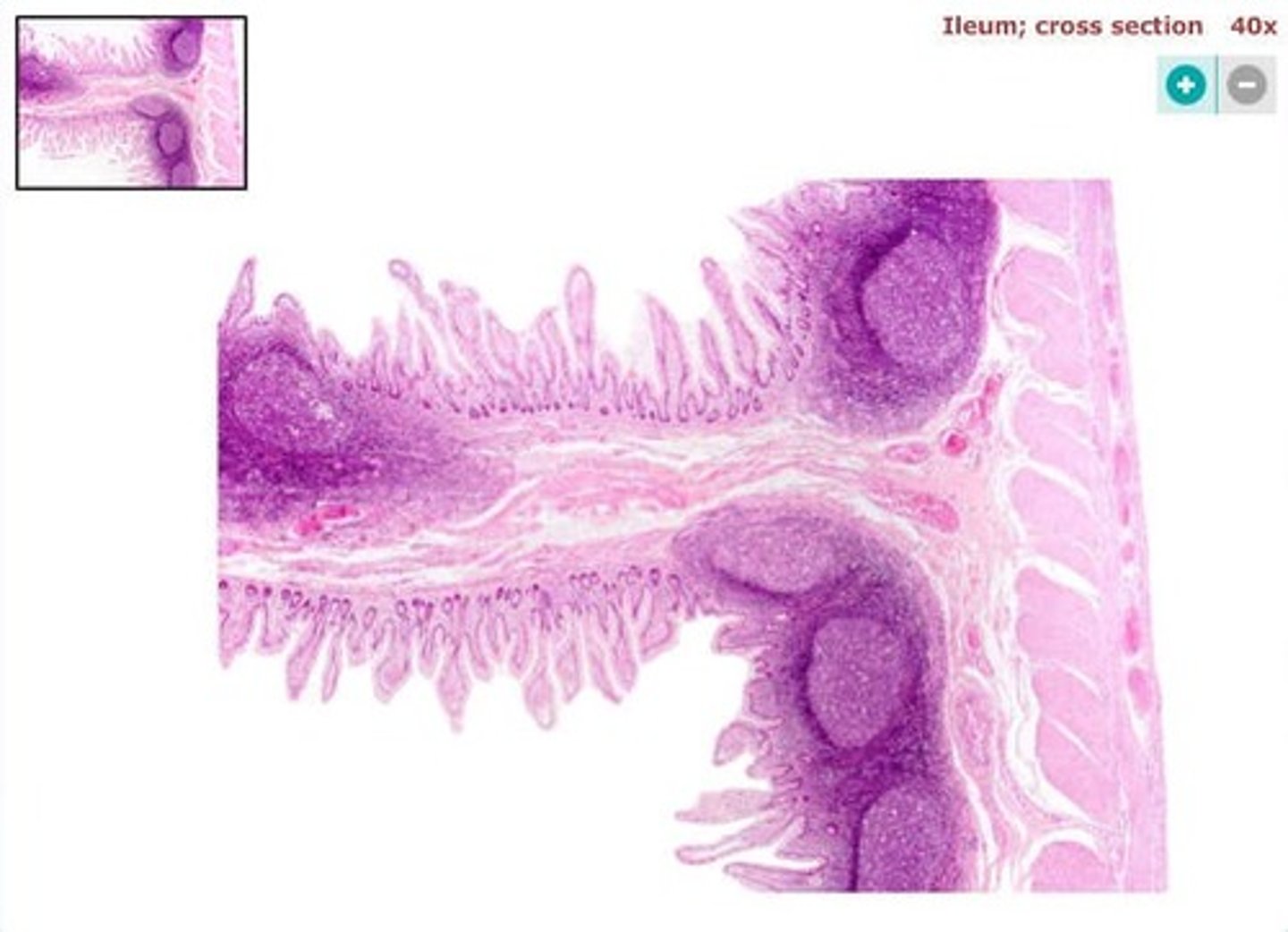 <p>simple columnar epithelium</p>