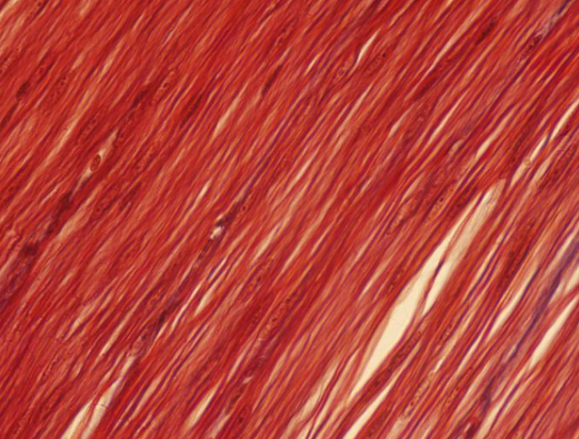 <p><span>Identify the type of muscle tissue shown?</span></p>