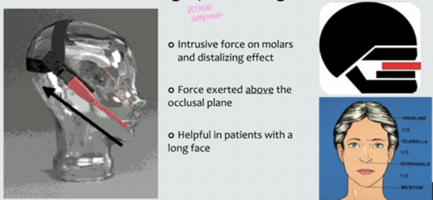 <p>Class II</p><p>Removable</p><p>Functional</p>