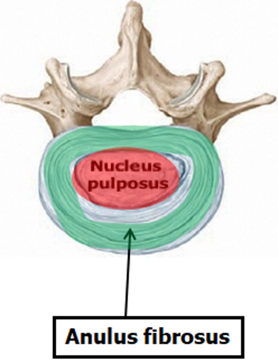 <p>- Outer anulus fibrosus → fibrocartilage layers</p><p>- Inner nucleus pulposus → gel-like center</p><p>- Functions as shock absorber between vertebrae</p>