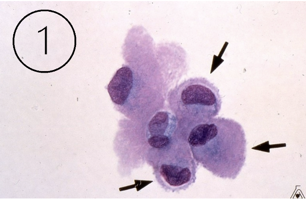 <p>What do these cells indicate?</p>