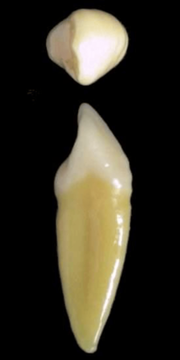 <p>what tooth is this &amp; why?</p>