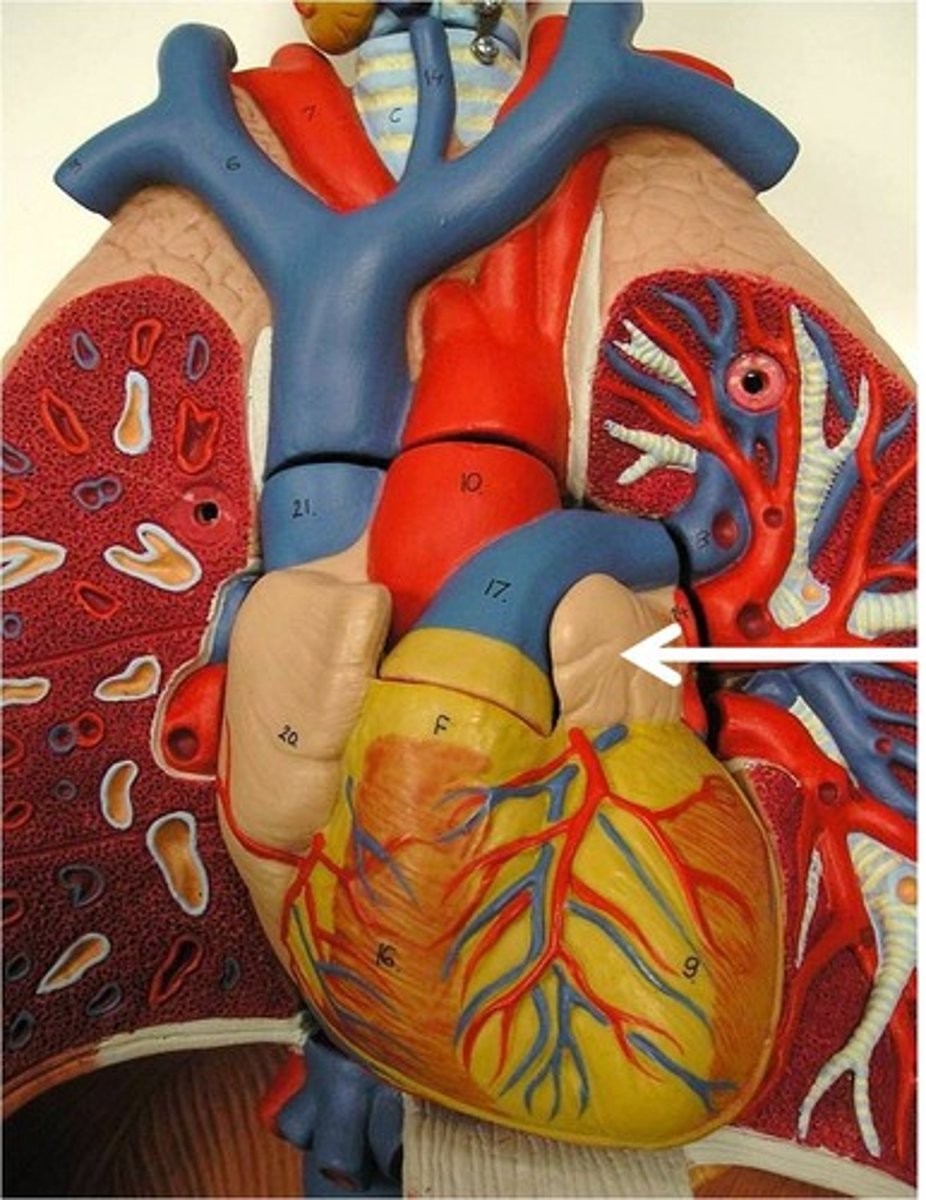 <p>Chamber. Ear on the DH.</p>