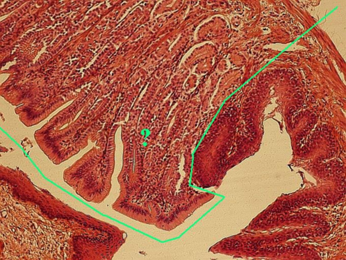 <p>Which portion of the gastroesophogeal junction is indicated?</p>