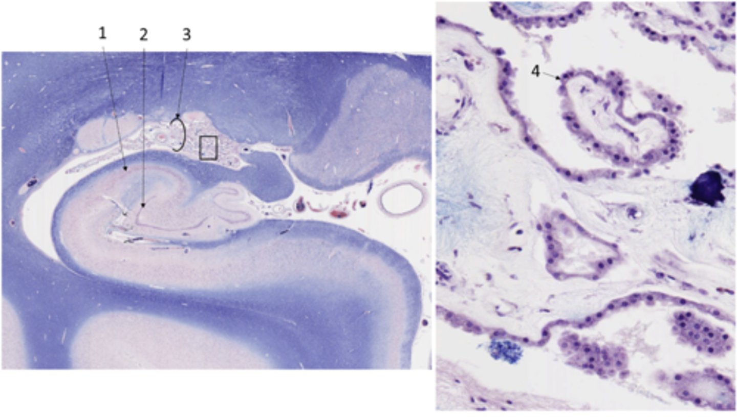 <p>Identify the structure at 3 (enlarged at the right)</p>