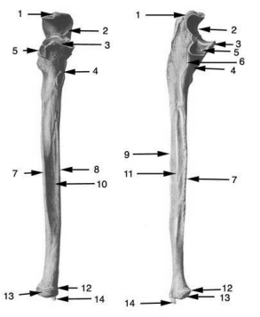 <p>Head of Ulna</p>