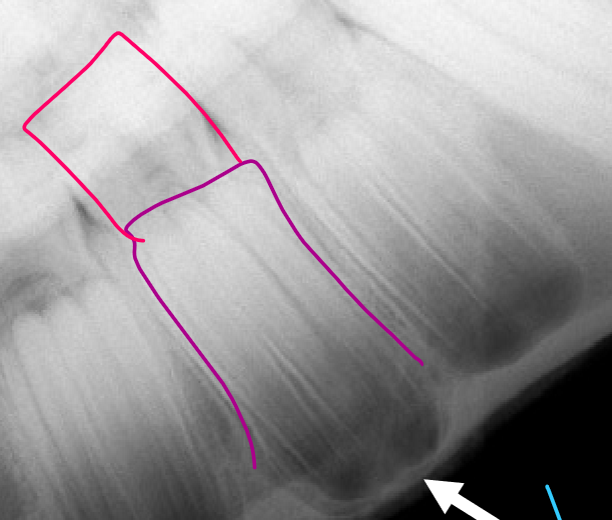 <p><span><span>What is the pink structure?</span></span></p>