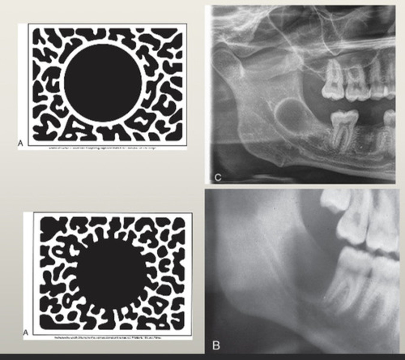 <p>Cysts, benign tumors</p>