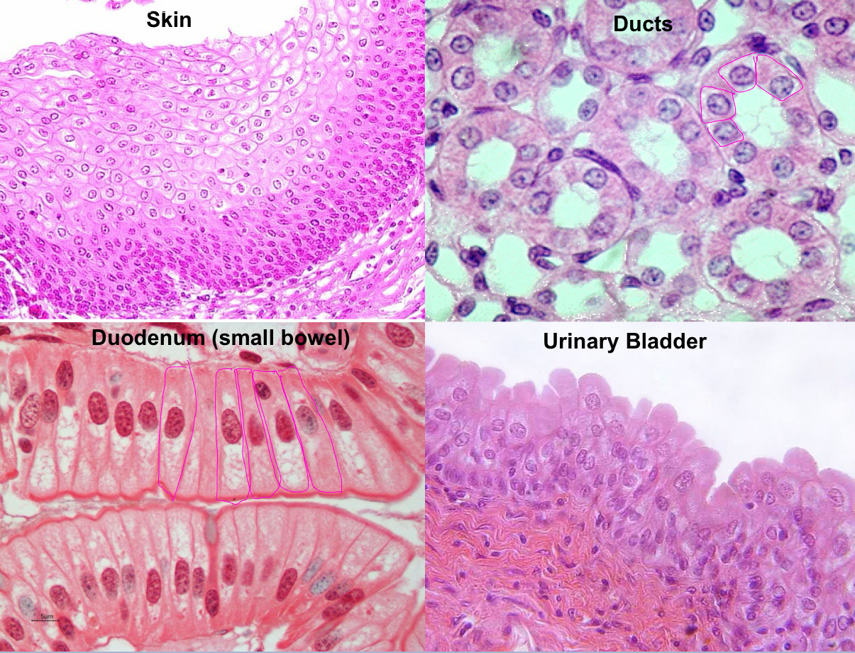 <p>What type of epithelial cells?</p>