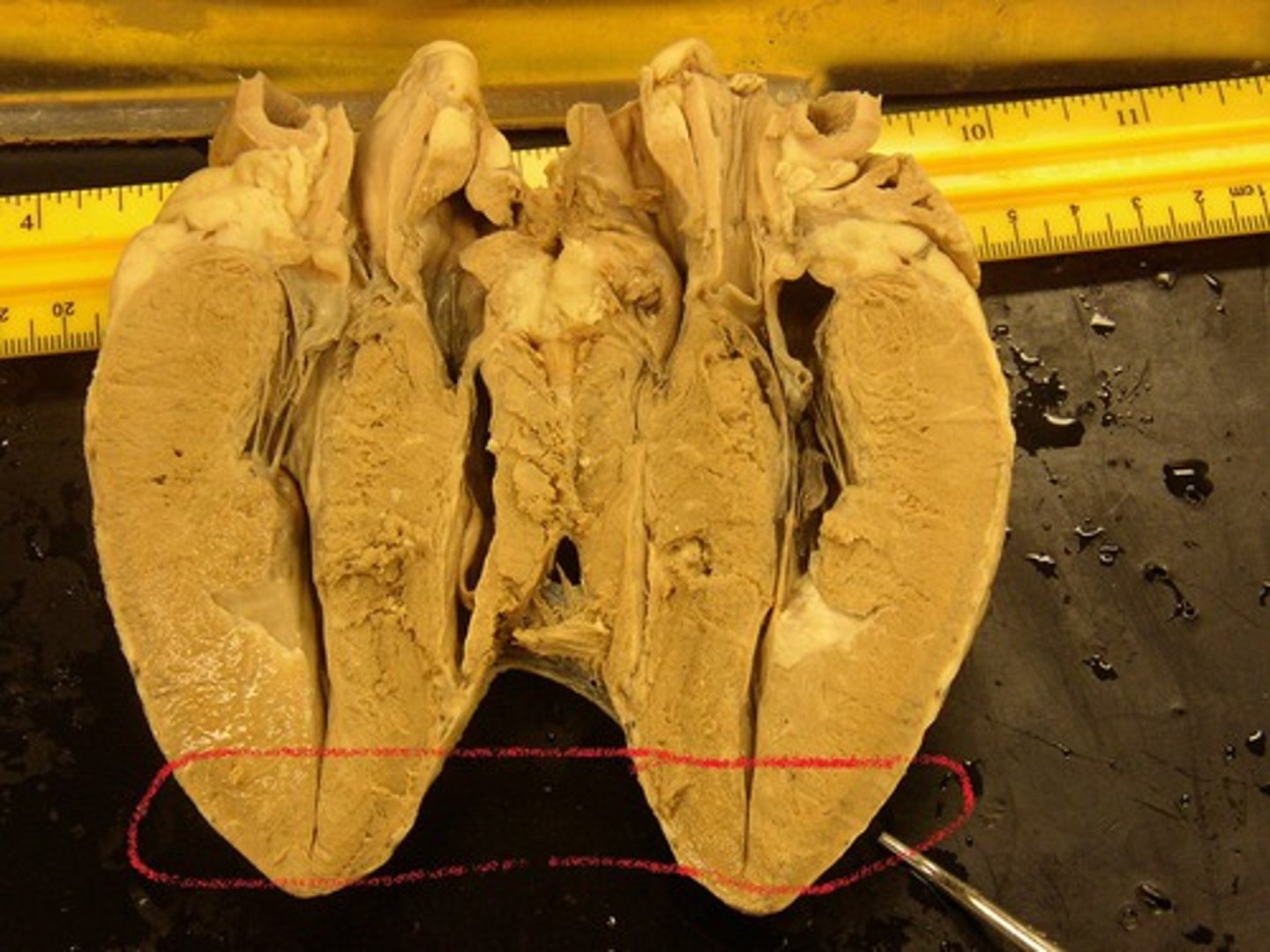 <p>bottom, pointed part of the heart</p>