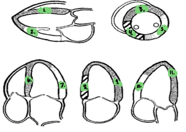 <p>Label the coronary artery wall segments: (11)</p>