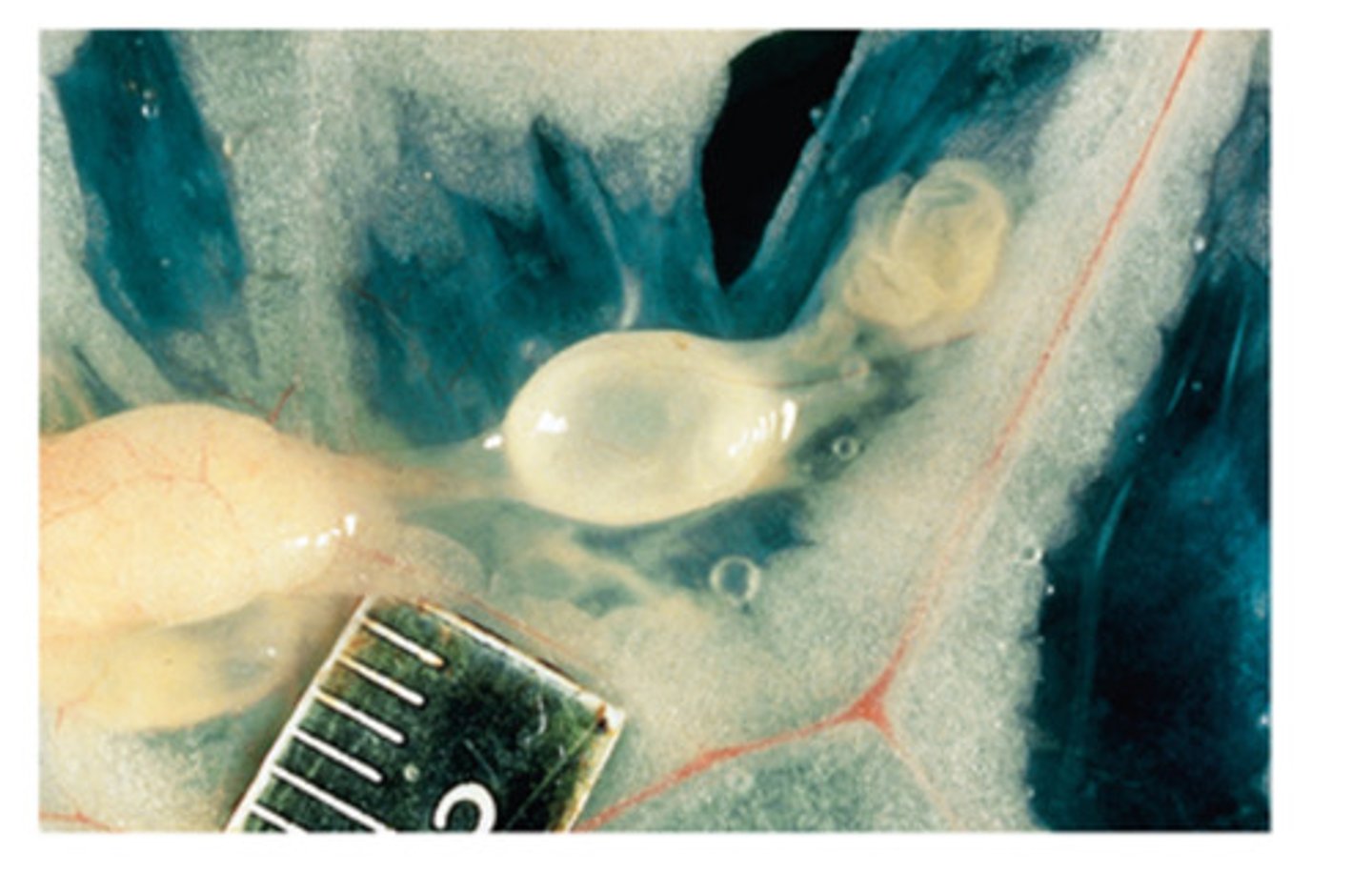 <p>This tapeworm bladder worm larval stage is found in the greater omentum or abdominal organs of the rabbit. The definitive host is the dog. What is the tapeworm called?</p>