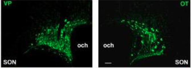<p>The SON is very homogeneous in that all projection neurons are magnocellular and all are neurophysin-positive, i.e. they all express either OT or AVP. Virtually all of them project to the posterior pituitary.</p>