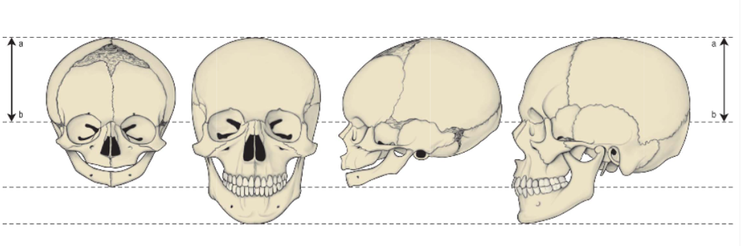 <p>postnatal growth of the skull </p>