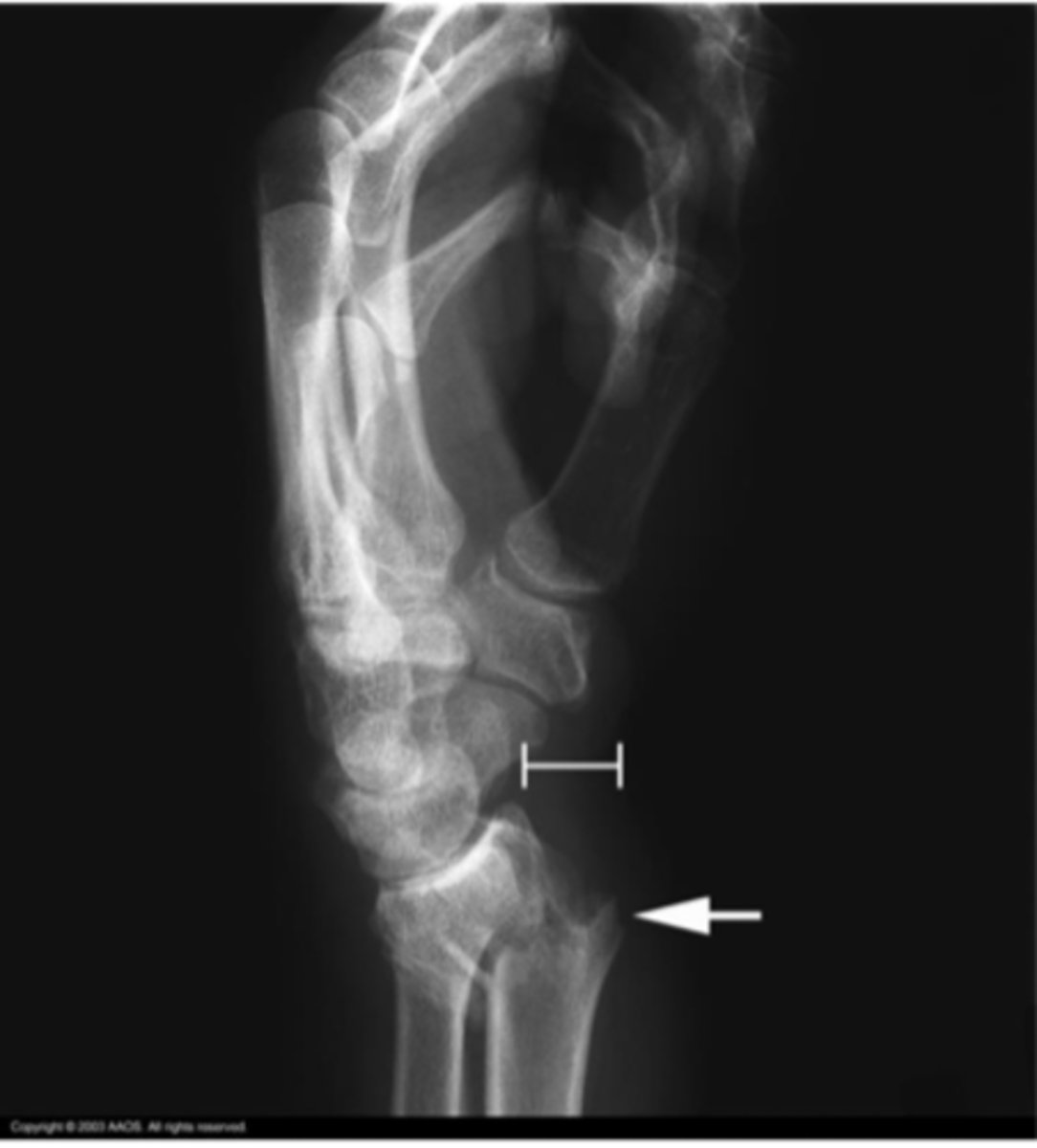 <p>What is the issue?</p>