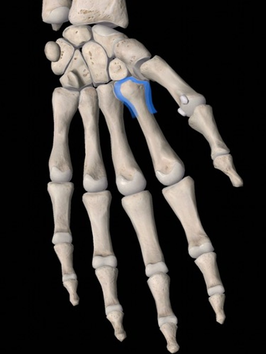 <p>bone</p>