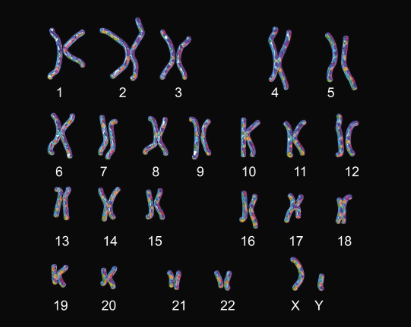 <p>The entire collection of chromosomes in each cell of an organism. In humans, this contains 24 kinds of chromosomes, 3,000,000,000 base pairs, and around 27,000 genes.</p>
