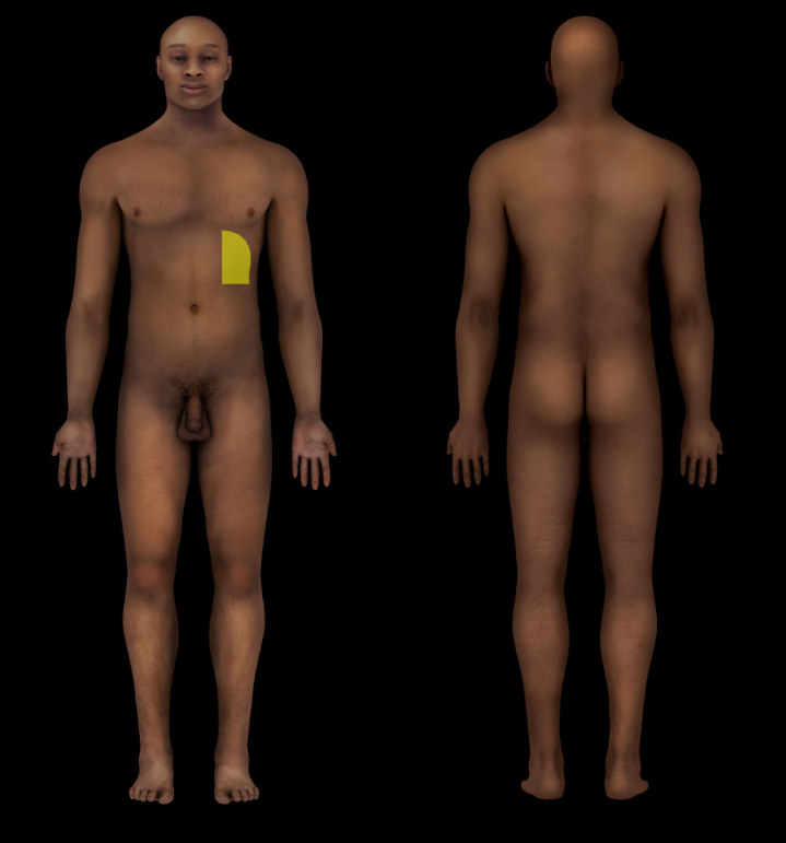 term image