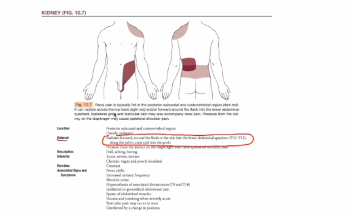 <p></p><ul><li><p>BONUS</p></li></ul><ul><li><p>A, B, C, D - referred pain of kidney&nbsp;</p></li><li><p>Murphy’s Percussion Test - kidney problem</p></li></ul><p></p>