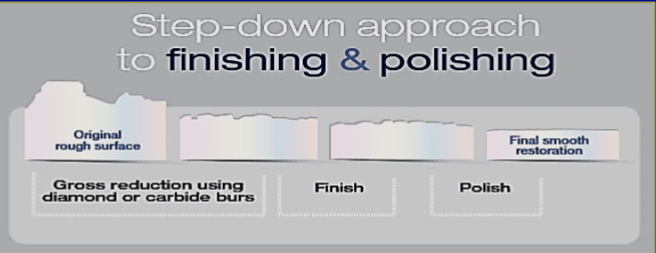 <p>step-down approach to finishing and polishing </p>