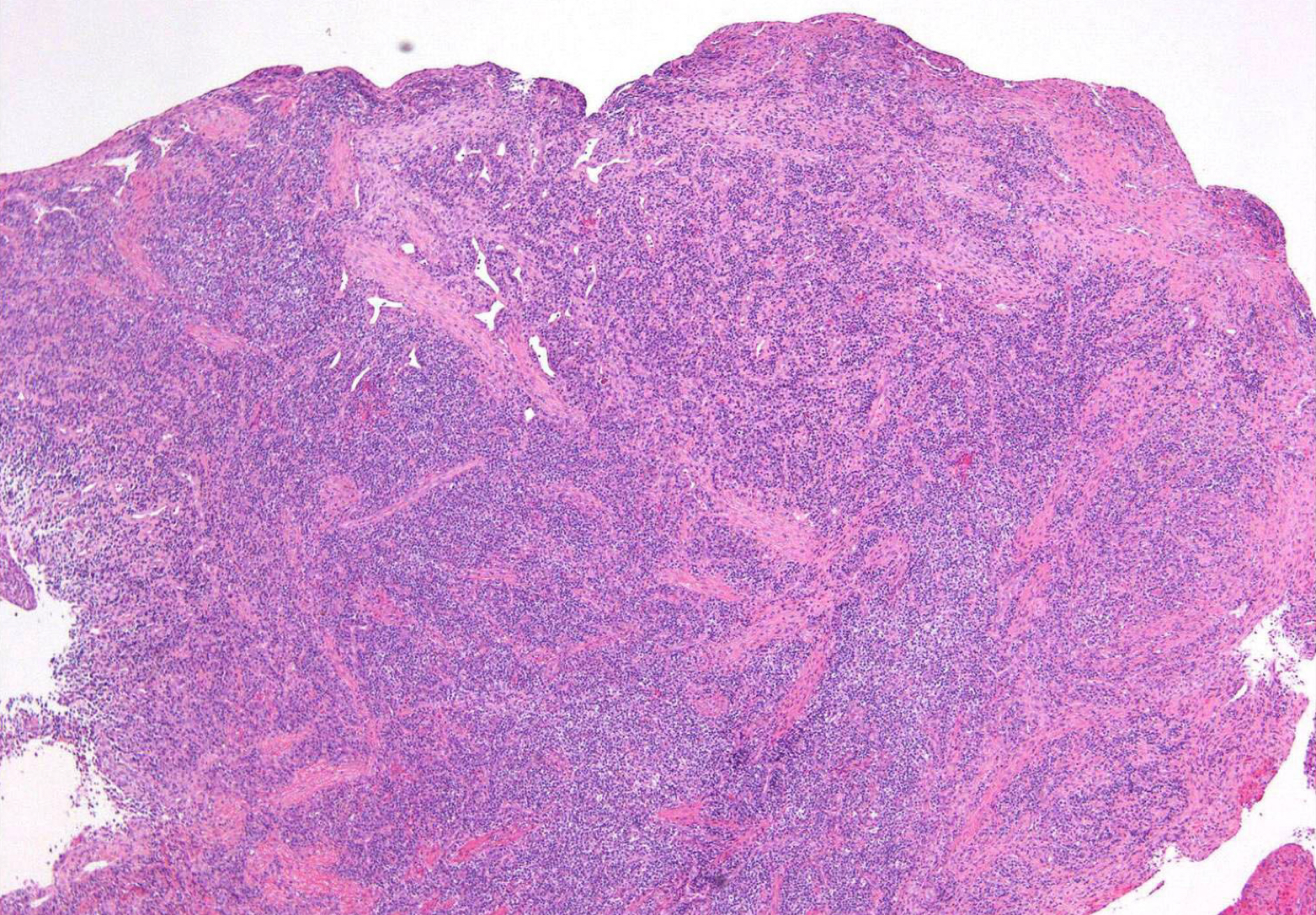 <p>which potential result of periapical inflammation?</p>