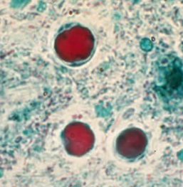 <p>Professor: Dr. Glena Fe A. Yapchulay-Alcabasa</p>