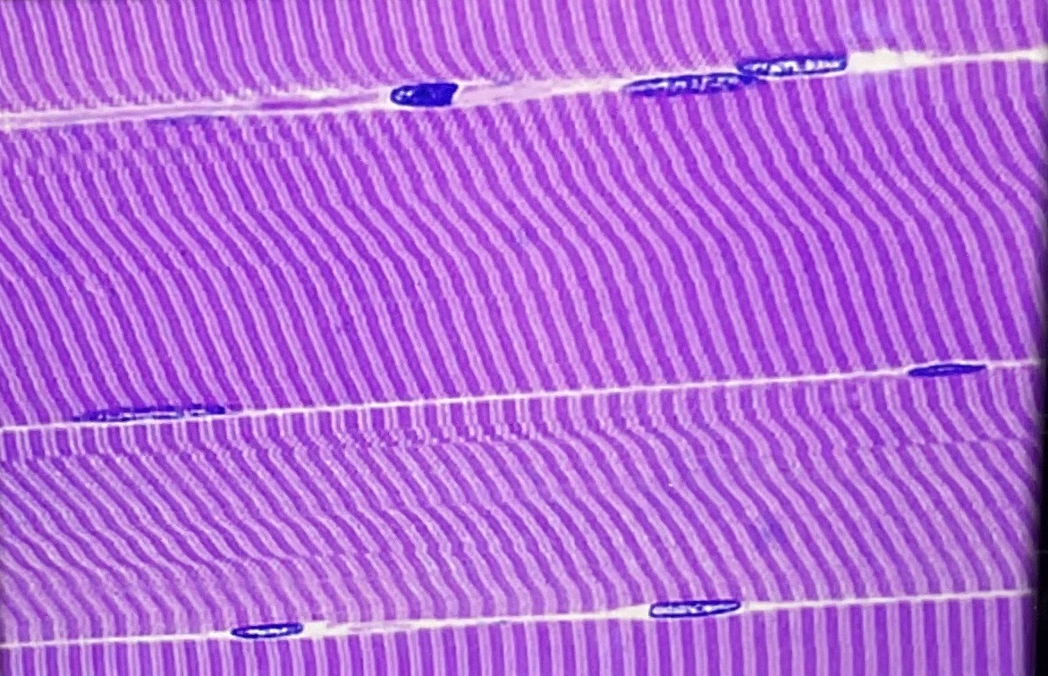 <p>What tissue muscle type is this? What is its function?</p>