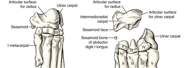 <ul><li><p>Carpus = wrist</p><ul><li><p>Horse = knee</p></li><li><p>Variety among species</p><ul><li><p>Humans and pigs have 8 bones</p></li></ul></li></ul></li><li><p>2 rows of bones</p><ul><li><p>Proximal</p><ul><li><p>Radial carpal bone: medial</p></li><li><p>Ulnar carpal bone: lateral</p></li><li><p>Accessory carpal bone: lateral</p></li></ul></li></ul></li><li><p>Distal</p><ul><li><p>Numbered, starting at medial side</p><ul><li><p>(I – IV)</p></li></ul></li></ul></li></ul><p></p>