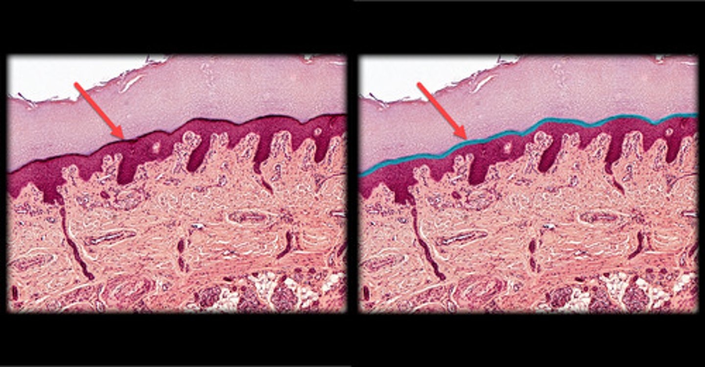 <p>- Middle layer, typically 3-5 cell layers thick.</p><p>- Cells appear more flattened with dark-staining keratohyalin granules in the cytoplasm, giving a grainy appearance under the microscope.</p><p>- Nuclei start to break down as cells prepare to become part of the stratum corneum.</p><p>- Forms a thin, dark band under the microscope, especially visible in thick skin.</p>