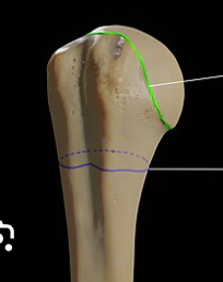 <p>(Green line)</p>