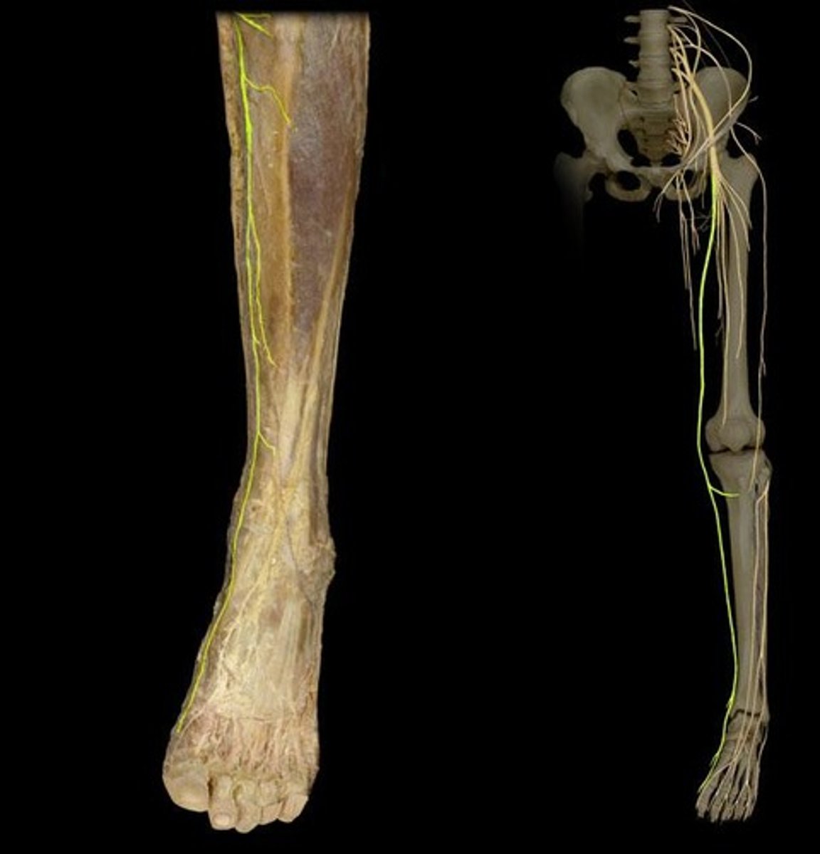 <p>Runs along the great saphenous vein, to innervate the medial leg and foot.</p>