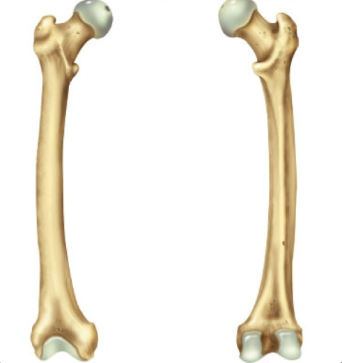 <p>What bone is this?</p>