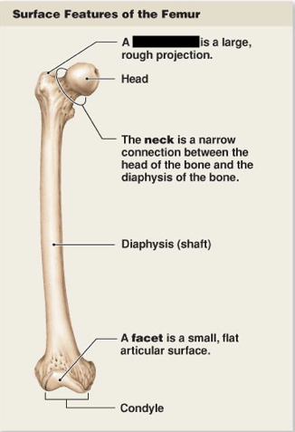 <p>this is the main surface features of the femur, what is this?</p>